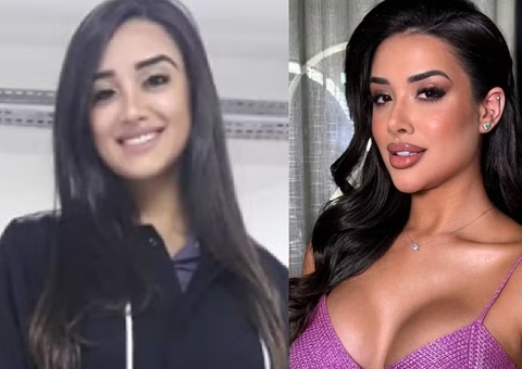 Candidata da Casa de Vidro investiu R$ 40 mil em plásticas antes do BBB26