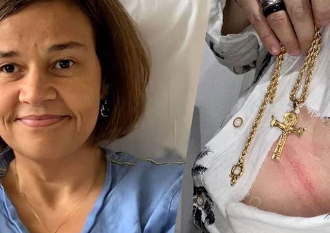 Claudia Rodrigues relata assalto e diz que empresária lutou com o bandido