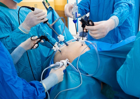 Plano de saúde terá de cobrir plástica de mulher que passou por bariátrica