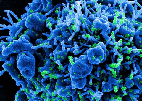 Nova cepa: Cientistas dizem que Brasil está virando celeiro do coronavírus