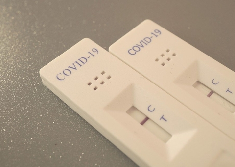 Amazonas registrou nas últimas 24 horas 77 novos de casos de Covid