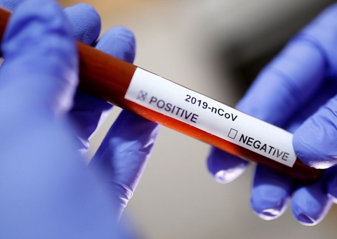 País registra 78,9 mil novos casos de covid-19 e mais 2,4 mil mortes