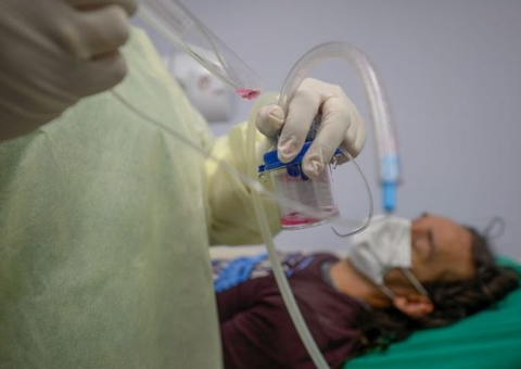 Casos de Covid-19 voltam a subir em todo País e alertam para nova onda