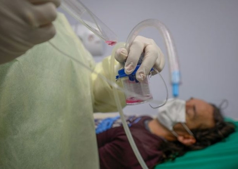 Variante Delta é principal ameaça para fim da pandemia mesmo após vacinação