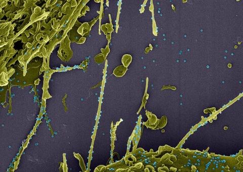 Fiocruz: média de mortes diárias por covid-19 cresce 60% em um mês