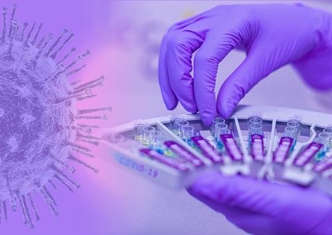 Amazonas tem 29 novos casos de covid-19 confirmados