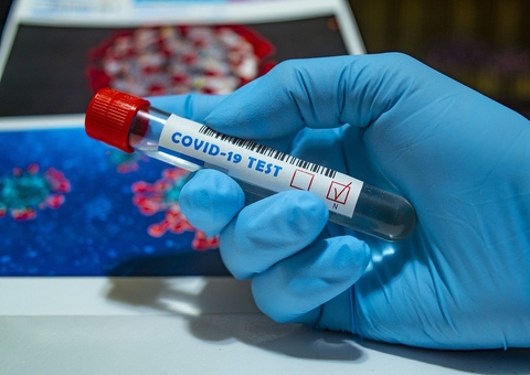 Há dois anos, cientistas confirmaram o surgimento da covid