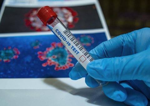 Brasil registra 85.149 novos casos de Covid em 24 horas