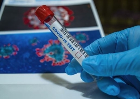 Amapá entra em fase vermelha de alerta para a coronavírus