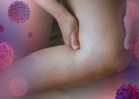 Covid-19: trombose pode acontecer até quatro semanas após recuperação