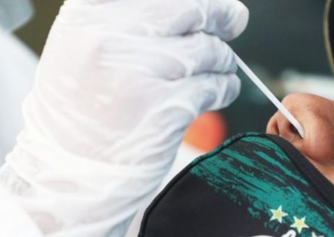 Amazonas tem  4 mortes por Covid-19 nas últimas 24h; internados somam 296 