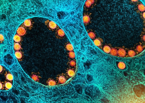 Covid-19: Brasil registra 32 mortes em 3,8 mil novos casos em 24 horas