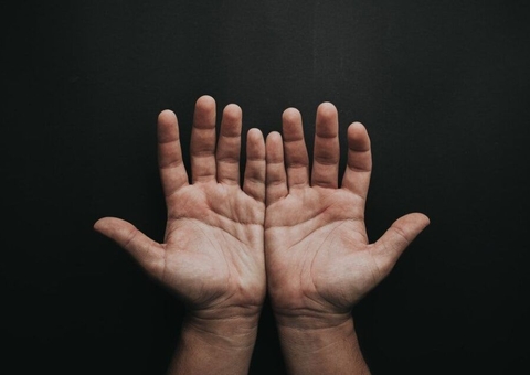 Siderúrgica vai indenizar trabalhador que perdeu dedos em acidente e foi apelidado de ‘Cotó’