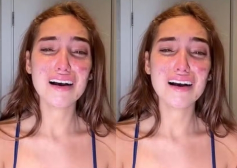 Vanessa Lopes chora ao mostrar rosto cheio de acne: "me sinto um monstro"