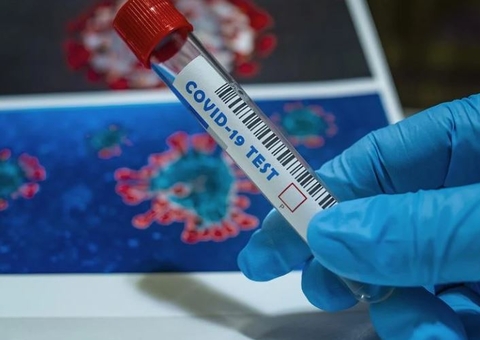 Brasil retoma pesquisa com plasma para combater a covid-19