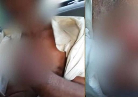 Patrão decepa mão de funcionário que roubou galinha por não receber salário