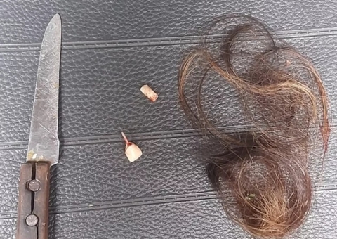 Mulher tem cabelo picotado e dentes quebrados ao ser agredida pelo namorado