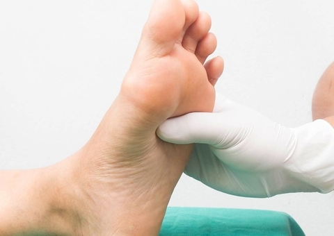 Feridas nos pés que demoram a cicatrizar podem indicar Diabetes Mellitus