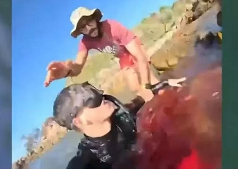 Jovem perde perna em ataque de tubarão e se filma sangrando: 'Me despedir'