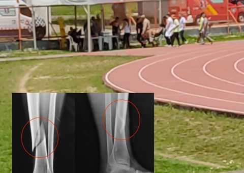 Candidata quebra as pernas em TAF do concurso do Corpo de Bombeiros em Manaus