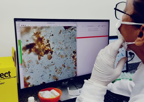 Manaus inaugura novo laboratório automatizado de diagnóstico de parasitas