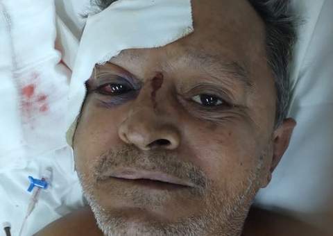 Hospital João Lúcio procura família de homem que foi atropelado em Manaus