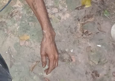 Homem é assassinado a pauladas em beco no Campo Dourado