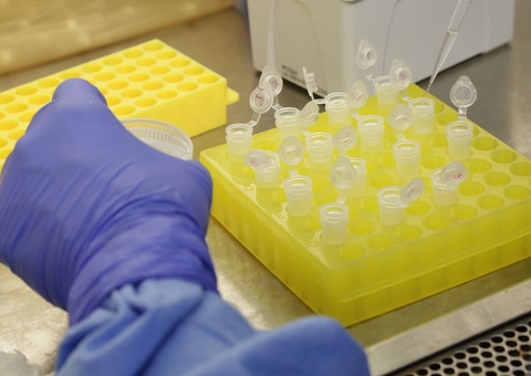 Testes para vacina contra HIV têm resultados promissores