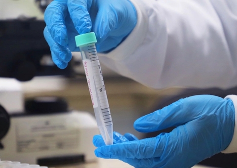 Saúde do Amazonas divulga medidas de prevenção da Mpox