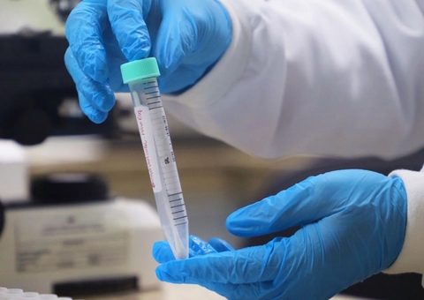 Covid-19, Influenza A e Rinovírus somam 55 dos 62 óbitos por SRAG no Amazonas