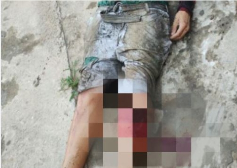 Homem tem perna dilacerada durante tiroteio no Santo Agostinho