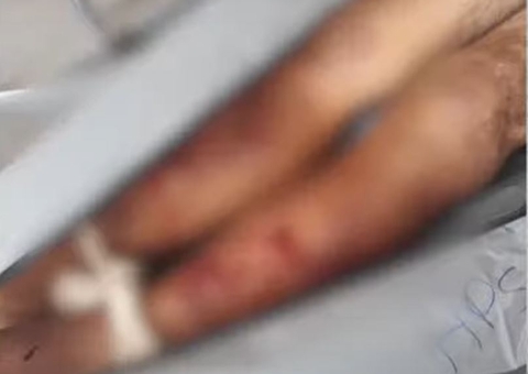 Idoso suspeito de estuprar criança morre após ser espancado em Manaus