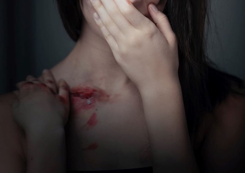 Adolescente é internada após sofrer estupro a caminho de padaria no Amazonas