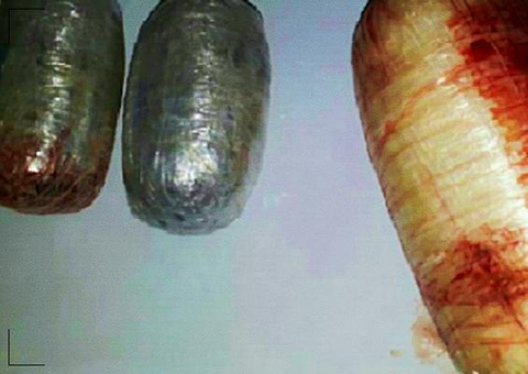 Mulher flagrada com droga na vagina alega consumo próprio. Tjam rejeita