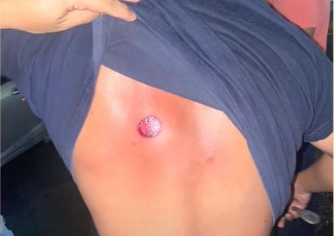 Vídeos: Motorista de app é agredido e colegas são expulsos à bala por PMs em Manaus