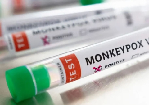 Anvisa aprova registro do primeiro teste da varíola dos macacos