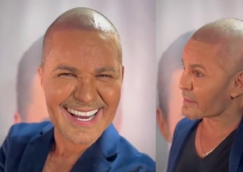 Eduardo Costa aparece careca e explica mudança: 'Usei muita bomba no passado'