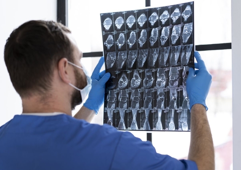 Fazendeiro vai indenizar trabalhador que caiu de mula e sofreu traumatismo