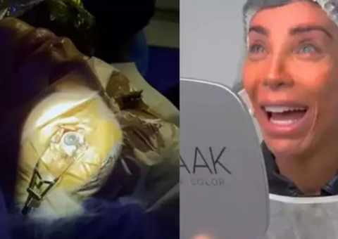 Maya Massafera faz cirurgia para mudar a cor dos olhos