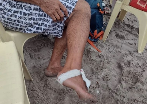 Banhistas são atacados por piranhas dentro de balneário em Manaus