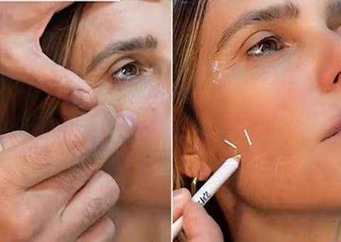 Dermatologista revela 4 procedimentos que evita no rosto de Fernanda Lima: 'gera flacidez'