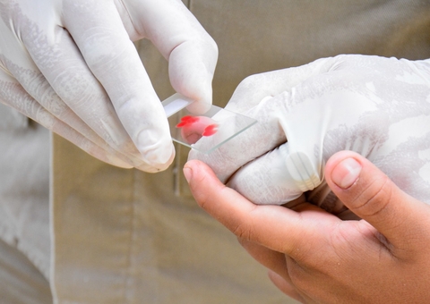 Manaus reduz em 50,3% casos de malária nos primeiros 4 meses do ano