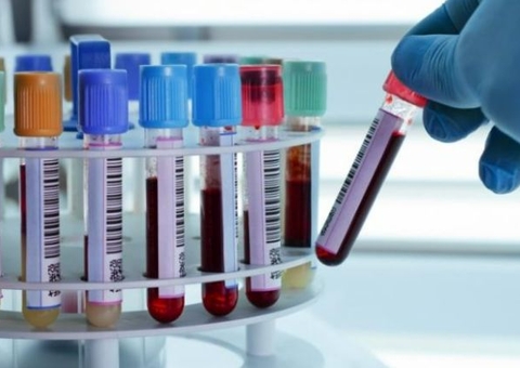 Exames clínicos custam R$ 5,4 milhões a Atalaia do Norte