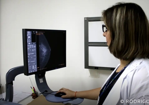 ANS estuda ampliar faixa etária para mamografia 