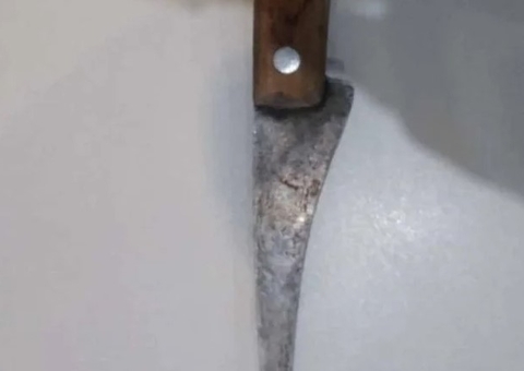 Durante discussão mulher de 30 anos é esfaqueada no rosto pelo pai