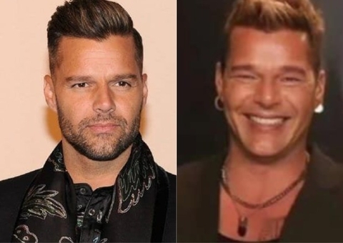 Harmonização facial? Ricky Martin surge irreconhecível, deixa Marcos Mion chocado e se pronuncia