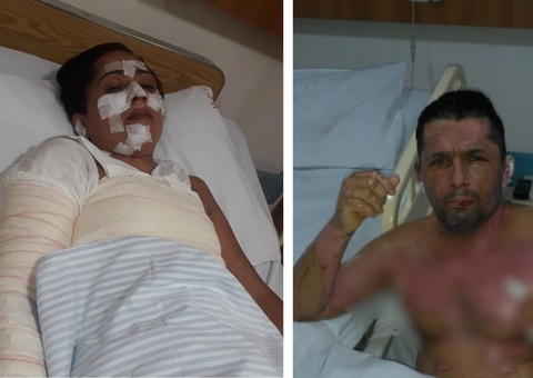 Sem dinheiro pro gás de cozinha, família se queima tentando fazer fogo