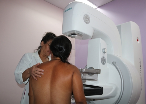 Fundação Cecon realiza mutirão de mamografias nesta quinta-feira