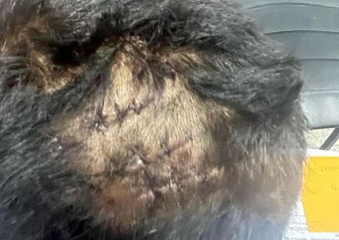 Criança tem cabeça quebrada por tomar mingau da irmã em Manaus 