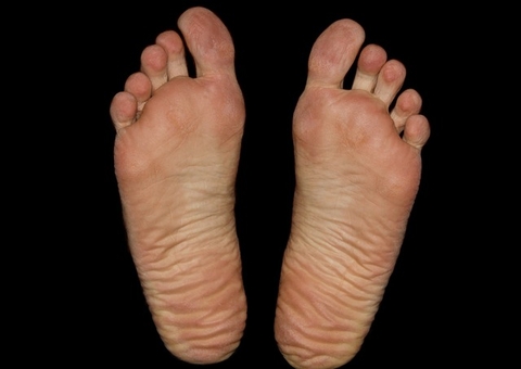 Especialista desmistifica os principais mitos sobre dores nos pés